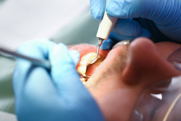 Best Pediatric Emergency Dentist in Montverde, FL