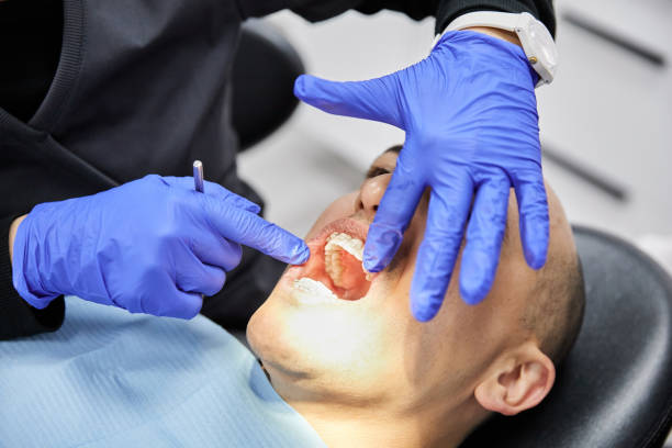 Best Urgent Care for Lost Fillings or Crowns in Montverde, FL